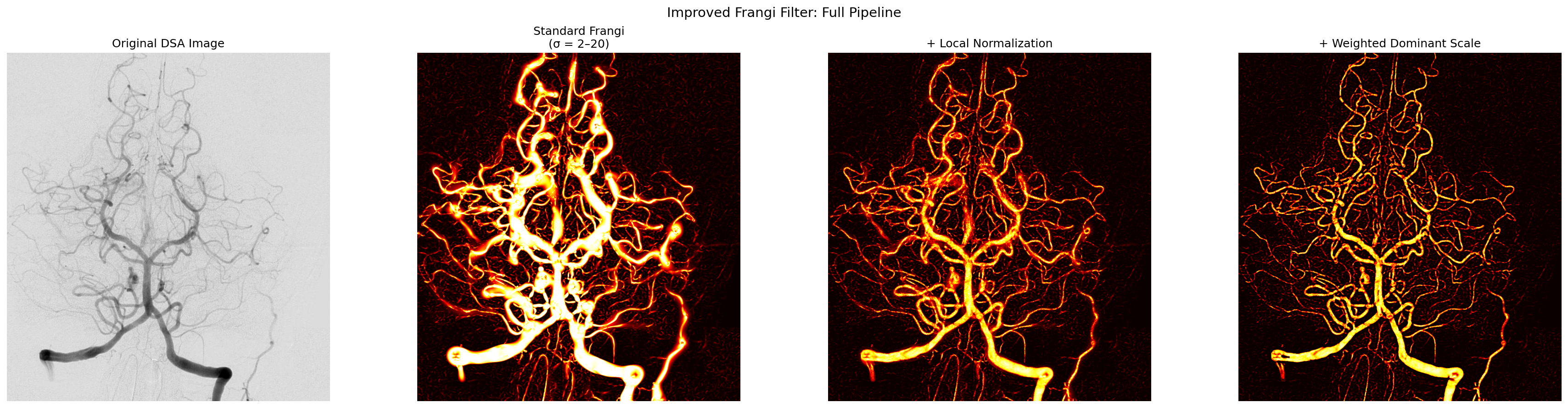 Comparison of standard Frangi filter, with local normalization, and with weighted dominant scale filtering